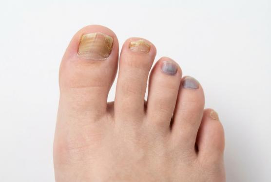 Soins du pieds Soins du pieds