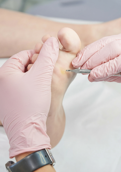 Soins des cors